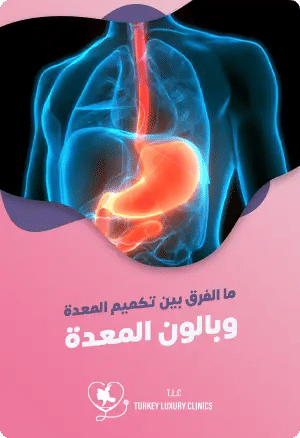 ما الفرق بين تكميم المعدة وبالون المعدة؟featured image