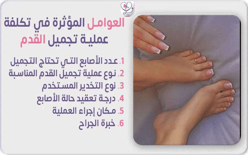 العوامل المؤثرة في تكلفة عملية تجميل القدم