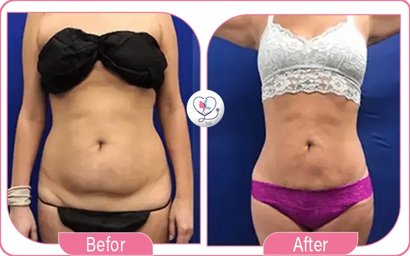 ثالثاً: ما بعد العملية