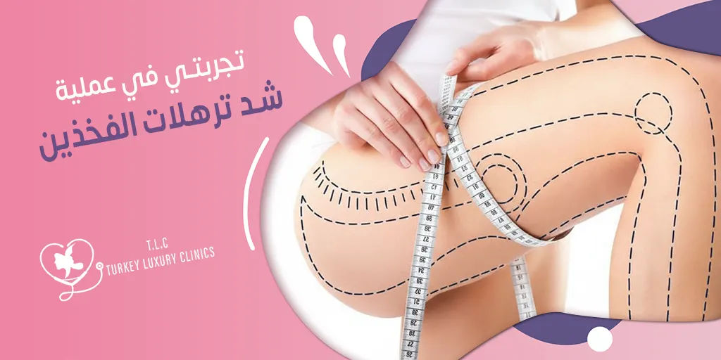 تجربتي في عملية شد ترهلات الفخذين