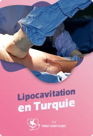 Lipocavitation en Turquie : amincissement sans chirurgiefeatured image