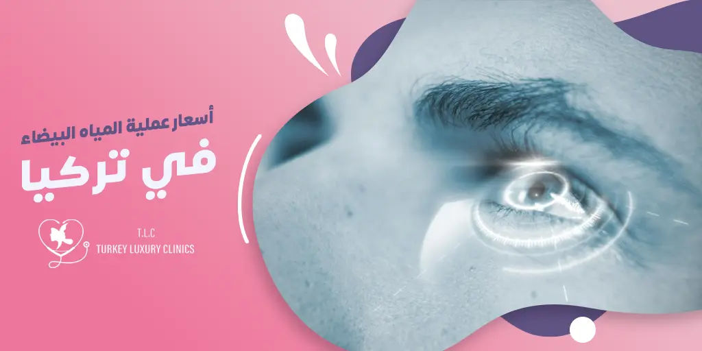 أسعار عملية المياه البيضاء في تركيا