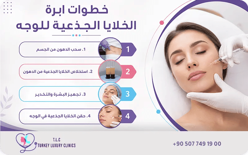 خطوات ابرة الخلايا الجذعية للوجه