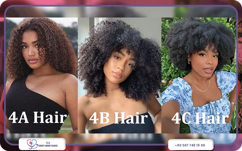 أنواع الشعر الأفريقي