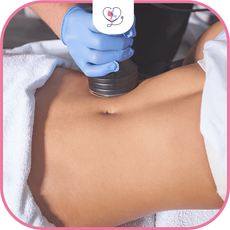 شفط الدهون بالموجات فوق الصوتية 