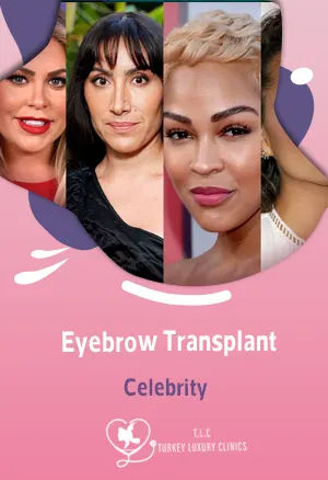 Eyebrow Transplant Celebrity: Fuller Brows of Chrissy Teigen, Meagan Good, and Jen Atkinfeatured image