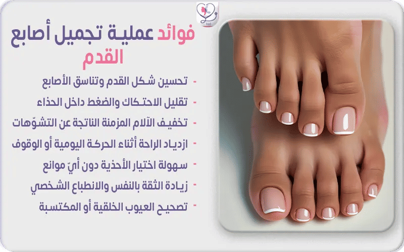 فوائد عملية تجميل أصابع القدم