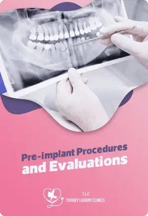 Pre-implant Procedures and Evaluationsfeatured image