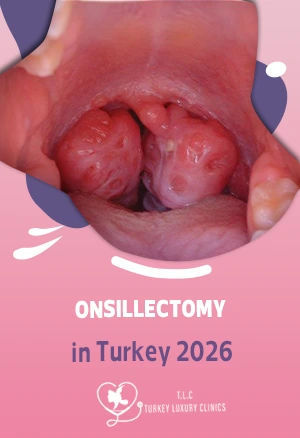 Tonsillektomie in der Türkei 2026: OP, Heilung & Kosten