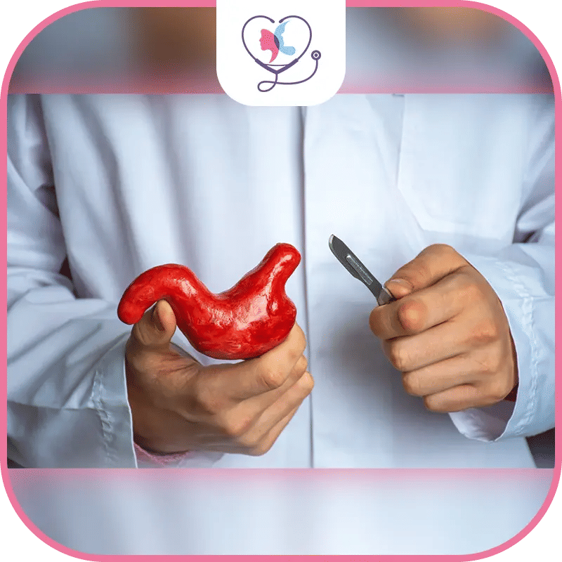 benefits of gastric sleeve