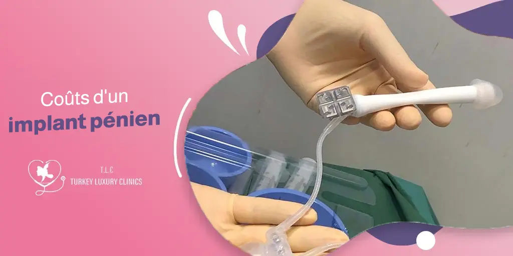 Coûts d'un implant pénien : quel est le prix en 2026 ? 