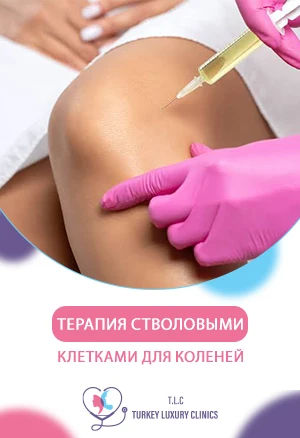 Терапия стволовыми клетками для коленей: новая надежда