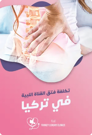 تكلفة فتق القنوات اللبية في تركياfeatured image