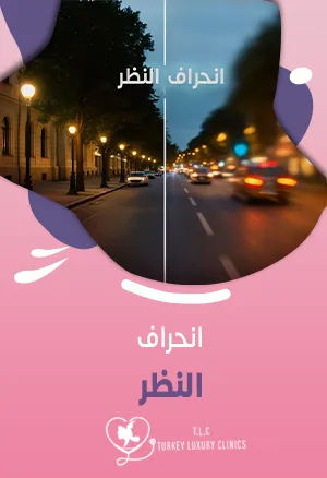 انحراف النظر: متى يتوقف؟ الأسباب والأعراض والعلاج