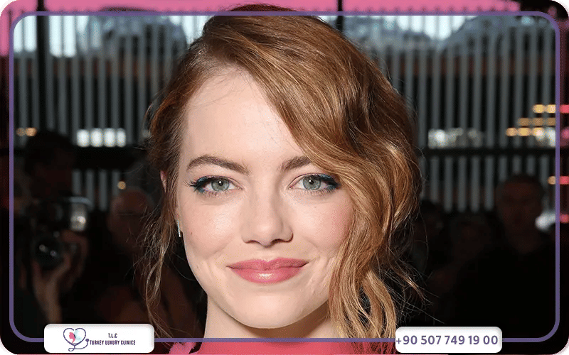 What Plastic Surgery Did Emma Stone Have?
