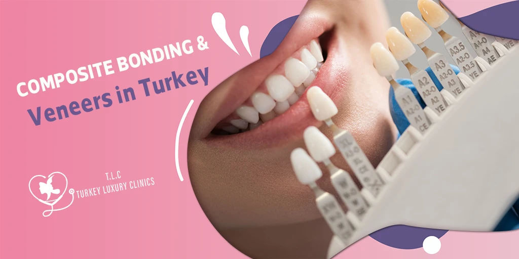 Composite Bonding & Veneers in Turkey: Prices & Packages in Istanbul, Antalya & Izmir 2026