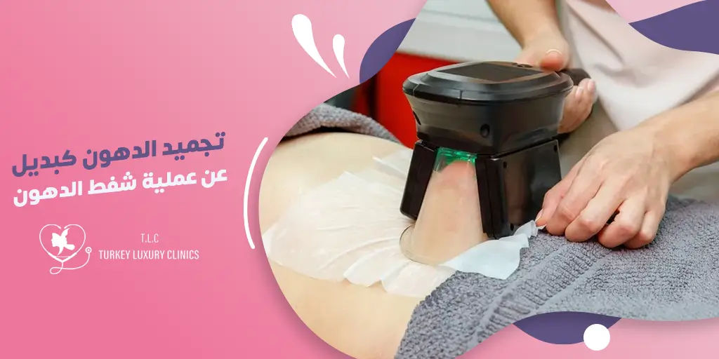 تجميد الدهون كبديل غير جراحي لشفط الدهون