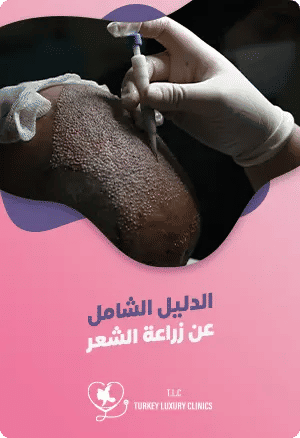 زراعة الشعر في تركيا: دليل شامل عن الأنواع والتقنيات والأسعار