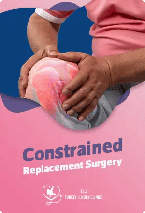 Constrained Knee Replacementfeatured image