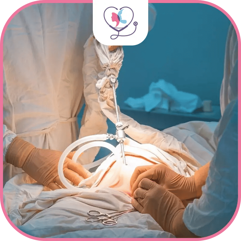 خامساً: الرعاية اللاحقة