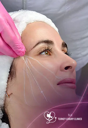 Thread Lift in Turkey: Cost, Results & Before and After
