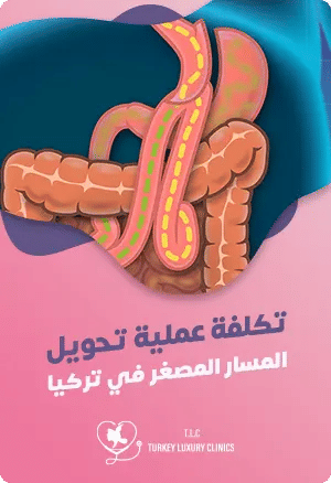 تكلفة عملية تحويل المسار المصغر في تركياfeatured image