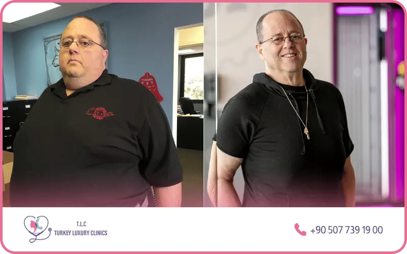  perte de poids rapide