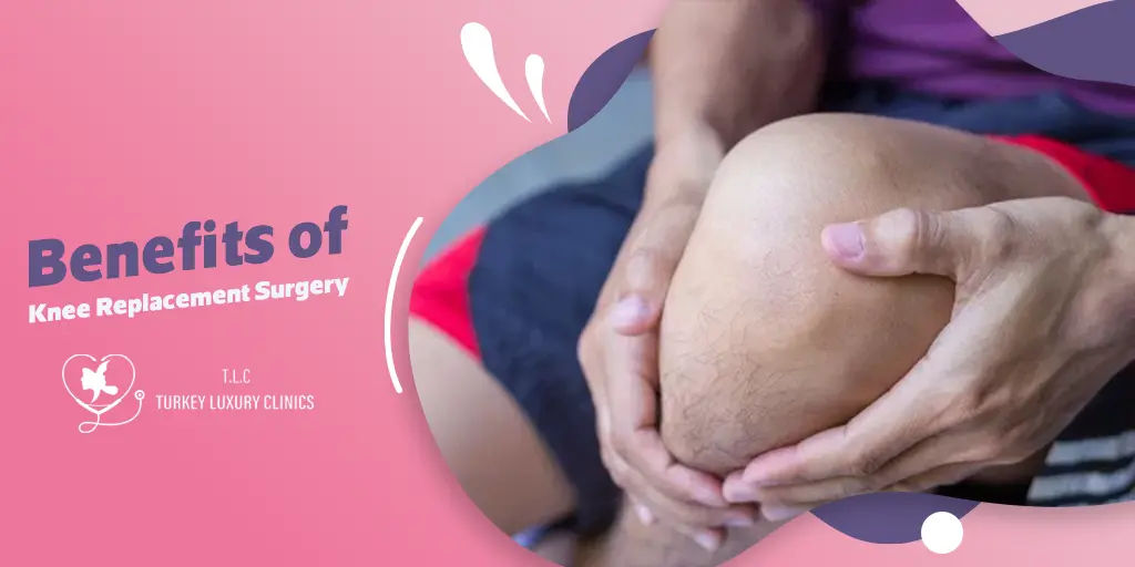 Top Benefits of Knee Replacement Surgery You Should Know