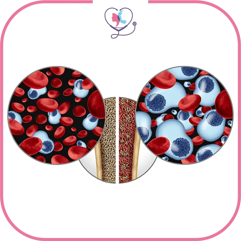 زراعة نخاع العظم في تركيا