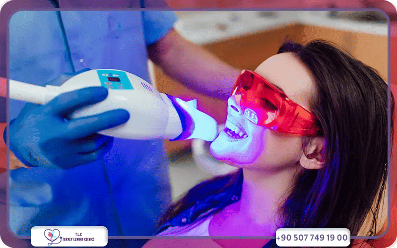 تجميل الأسنان عبر التبييض بالليزر
