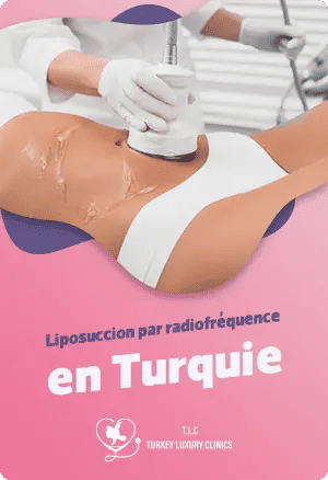 Liposuccion par radiofréquence en Turquie : remodelage corporel innovantfeatured image