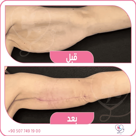 كيف اخترت الطريقة المناسبة لي؟ 