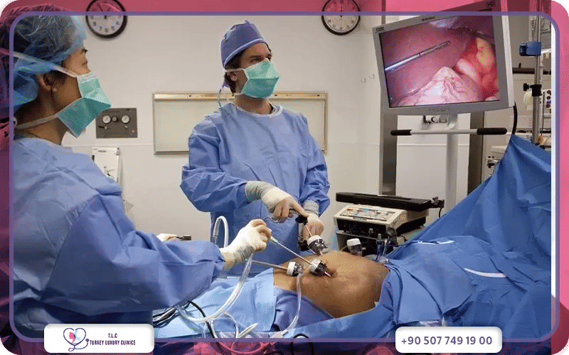 How to Choose the Best Gastric Sleeve Surgeon in Turkey