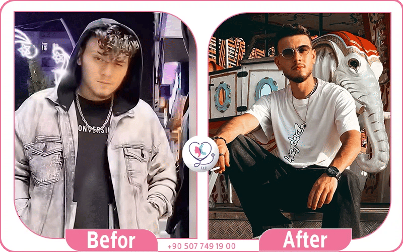 الشامي قبل وبعد النحف