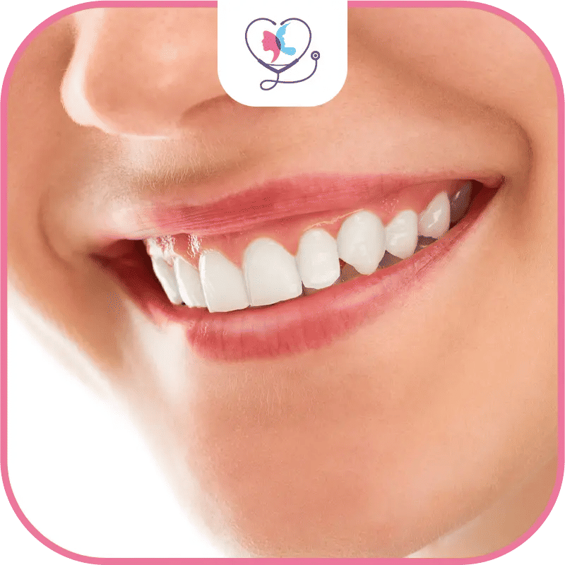 Cleaning Dental Implant Bridges and Dentures