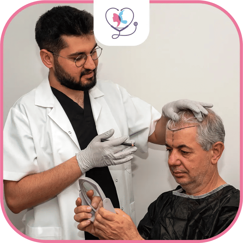 Identifying the Ideal Technique for Transplanting Hair Follicles