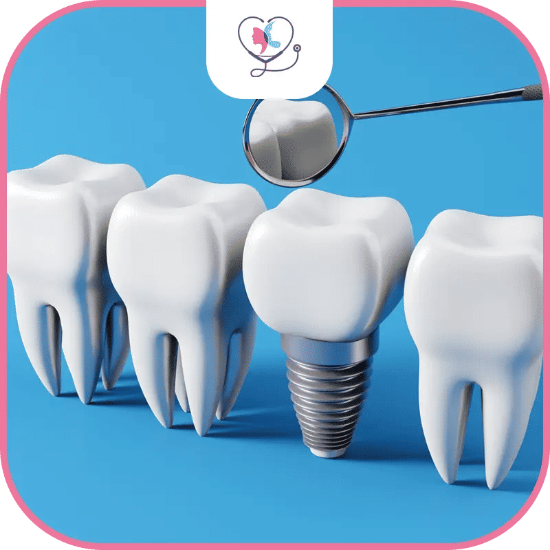 Single Tooth Dental Implant Recovery and Aftercare