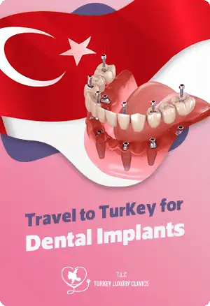 Travel to Turkey for Dental Implants: What You Should Know