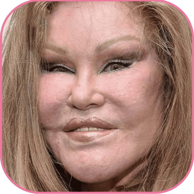 échecs en chirurgie esthétique