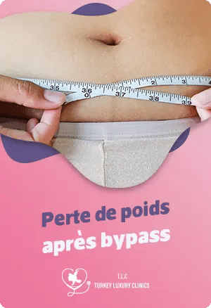 Perte de poids après bypass : Étapes et recommandations essentielles