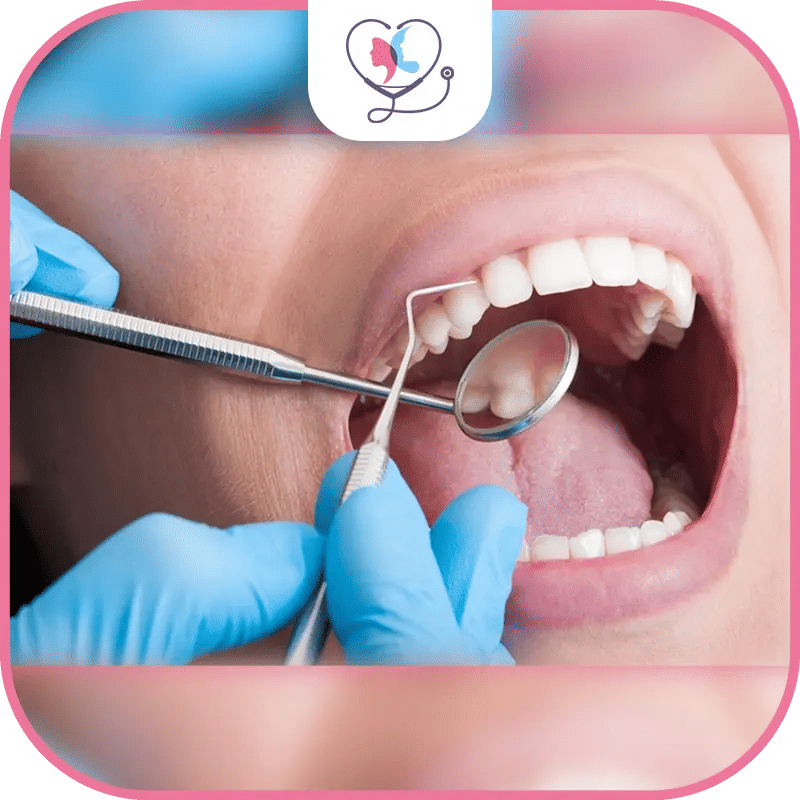 حساسية الأسنان