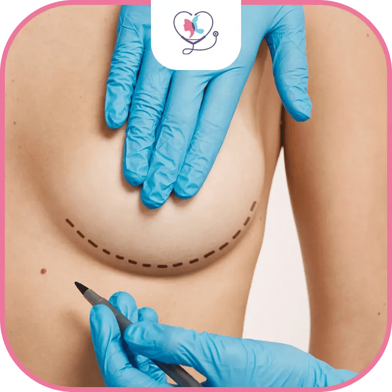 عملية تكبير الثدي في تركيا