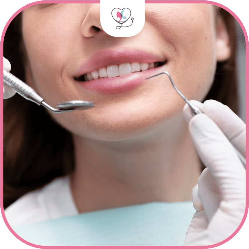 خطوات تركيب ابتسامة هوليود