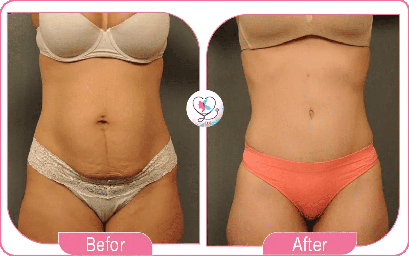 كيف تتجنب فشل العملية؟