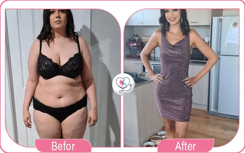 لماذا تختارين تركيا لاكشري كلينك؟ لماذا تختارين تركيا لاكشري كلينك؟