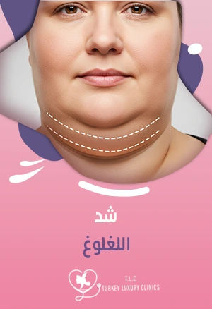 شد اللغلوغ: دليل شامل جراحة وبدون جراحة