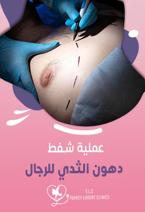 عملية شفط دهون الثدي للرجال: الخطوات والنتائج والأسعار