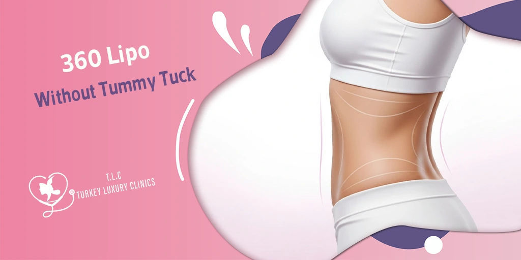 Liposucción 360 sin Abdominoplastia: Esculpe tu Cuerpo