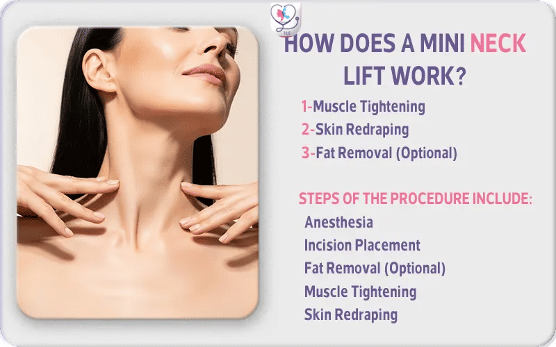 How Does a Mini Neck Lift Work?