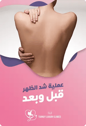 عملية شد الظهر قبل وبعدfeatured image